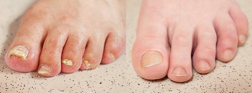 INFORMACJE DERMATOLOGICZNE